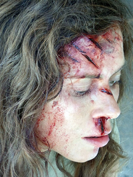 American Odyssey 
Anna Friel 
Prosthetic transfer wounds